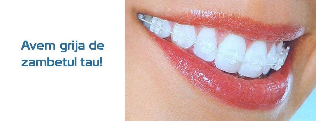 Ortodontie - indreptarea dintilor prin aparat dentar